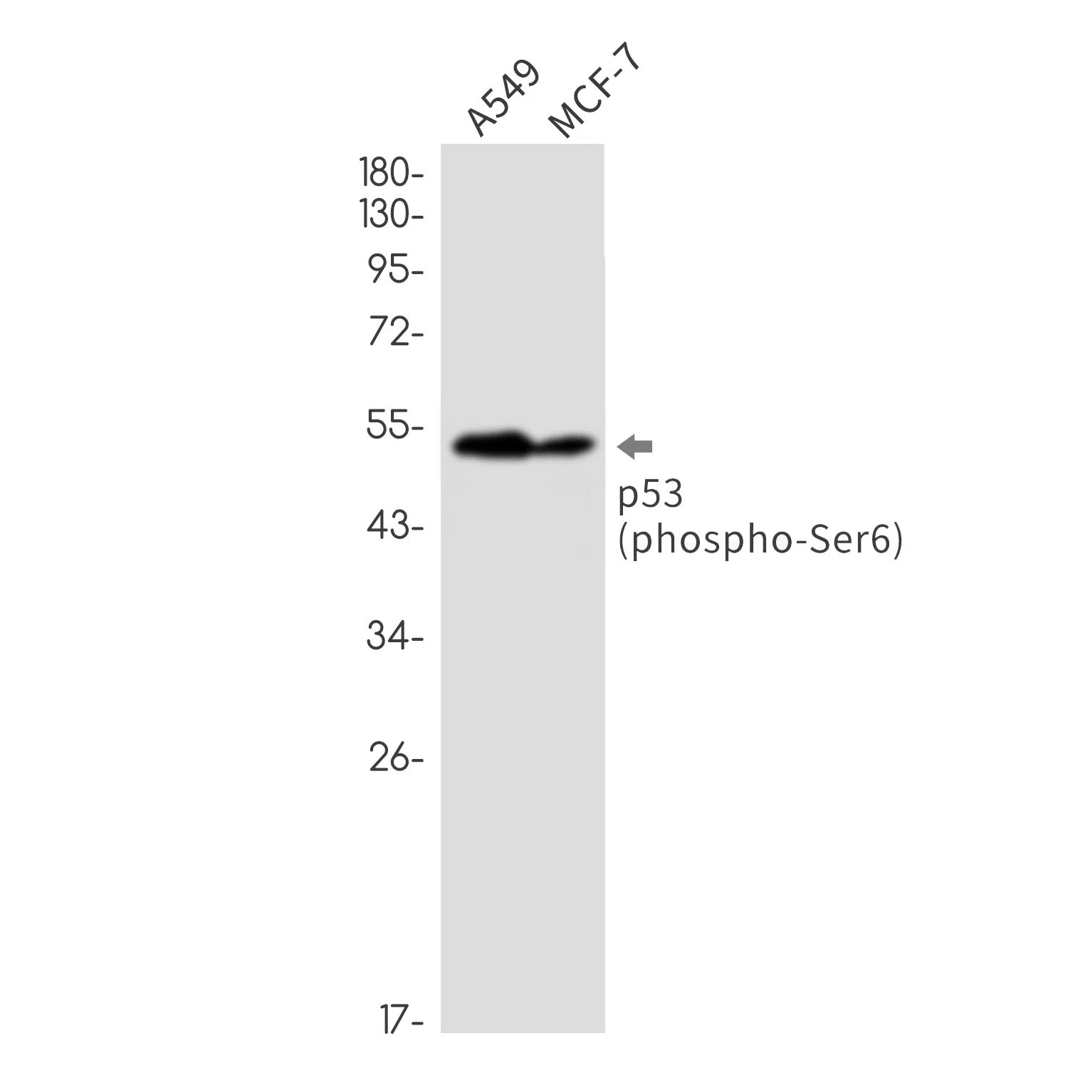 Phospho-p53 (Ser6) Rabbit Monoclonal Antibody - Size: 50µl