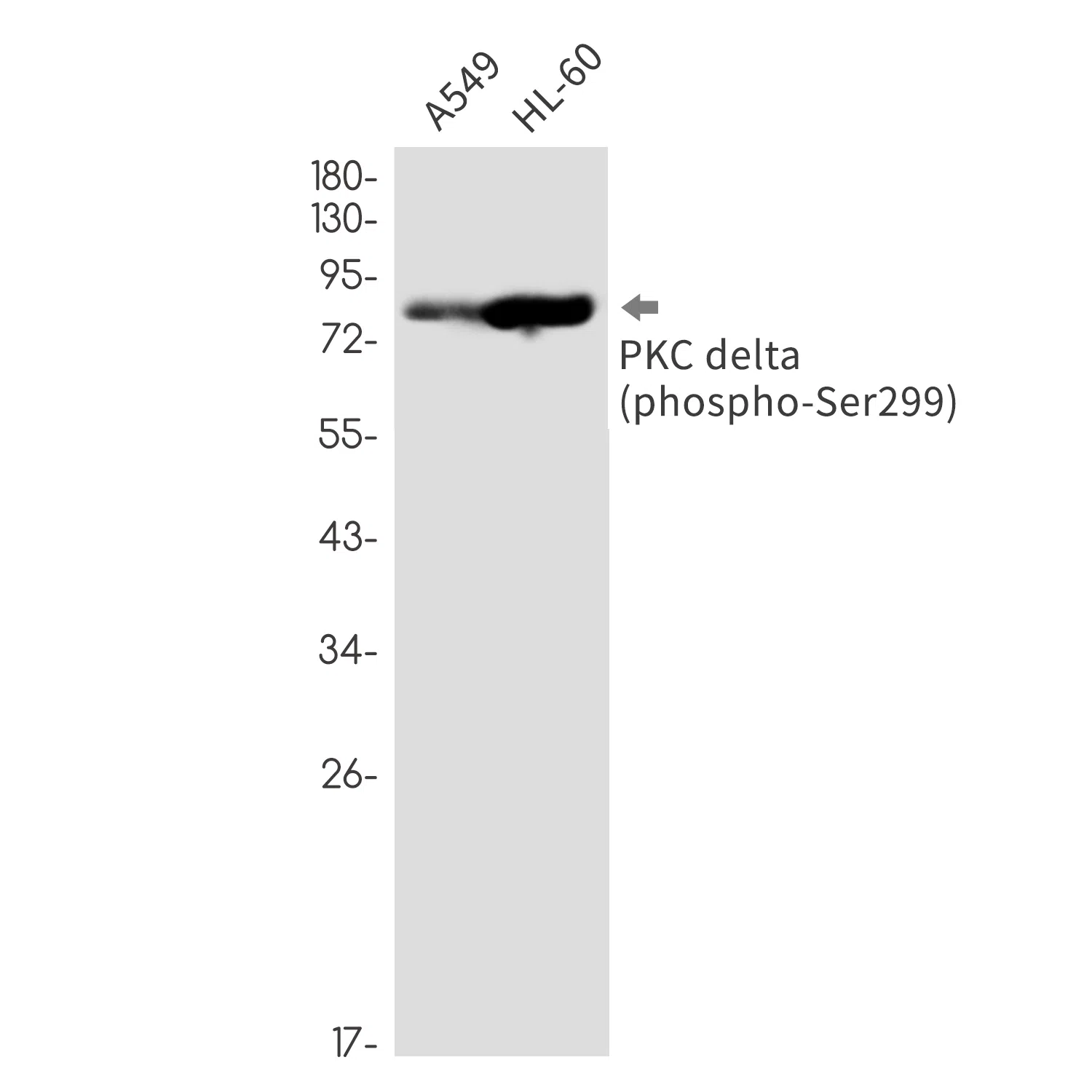 Phospho-PKC delta (Ser299) Rabbit Monoclonal Antibody - Size: 100µl