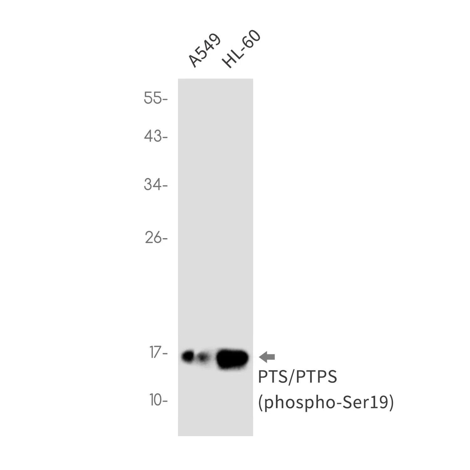 Phospho-PTS (Ser19) Rabbit Monoclonal Antibody - Size: 100µl