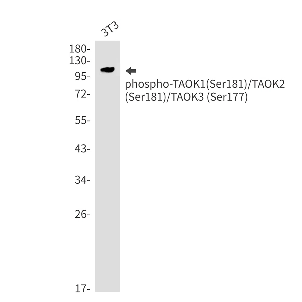 Phospho-TAOK1/2/3 (Ser181/Ser181/Ser177) Rabbit Monoclonal Antibody - Si