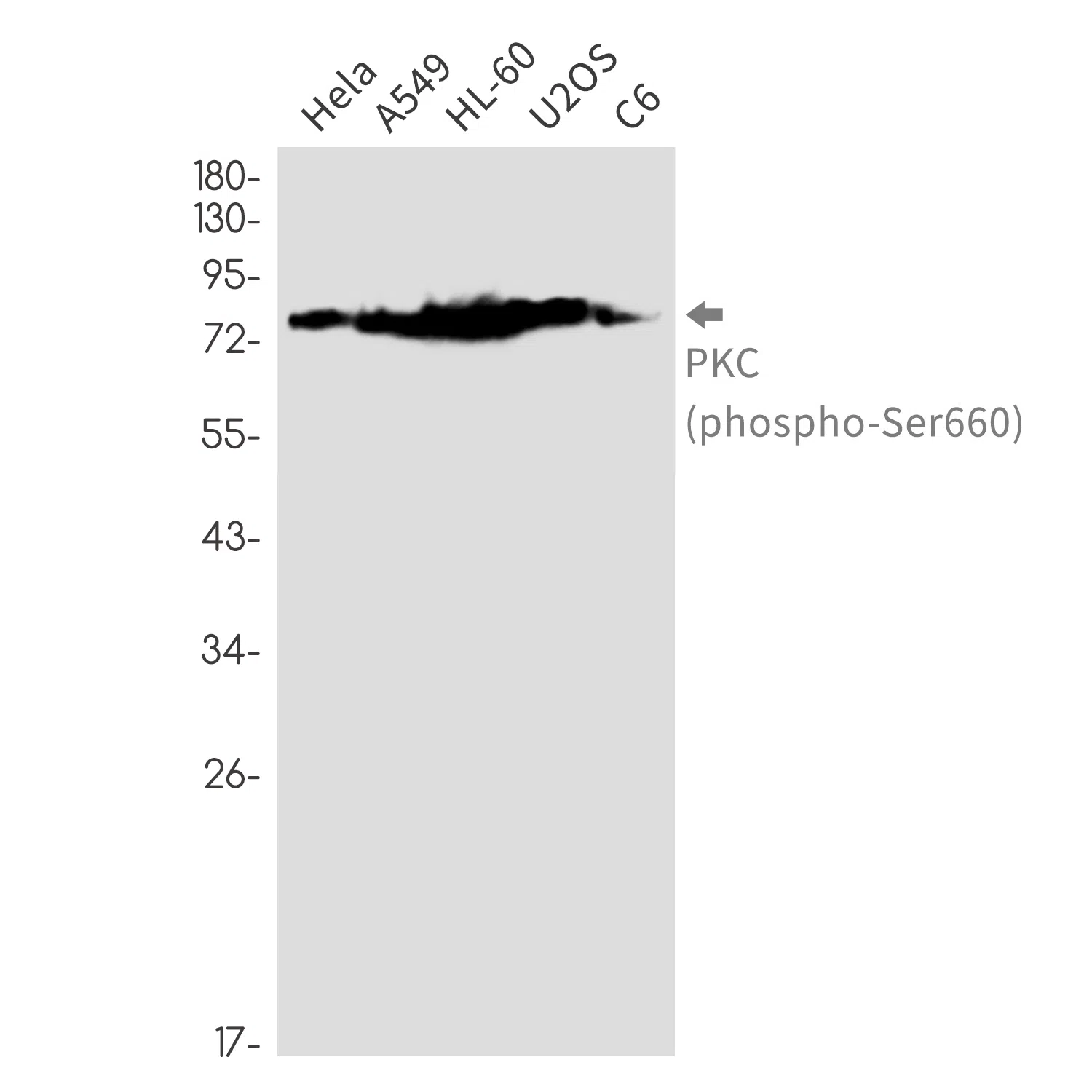 Phospho-PKC (Ser660) Rabbit Monoclonal Antibody - Size: 50µl
