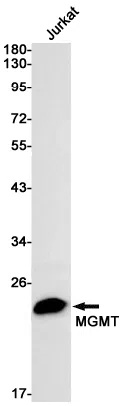 MGMT Rabbit Monoclonal Antibody - Size: 50µl