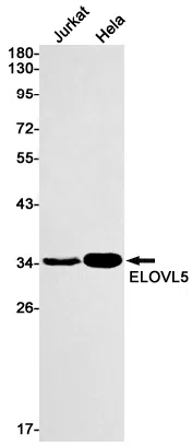 ELOVL5 Rabbit Monoclonal Antibody - Size: 50µl