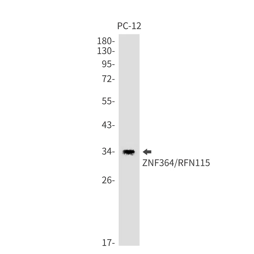 ZNF364 Rabbit Monoclonal Antibody - Size: 100µl