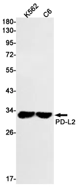 PD L2 Rabbit Monoclonal Antibody - Size: 50µl