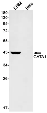GATA1 Rabbit Monoclonal Antibody - Size: 100µl