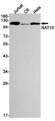 NAT10 Rabbit Monoclonal Antibody - Size: 50µl
