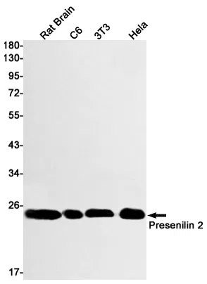 Presenilin 2 Rabbit Monoclonal Antibody - Size: 50µl