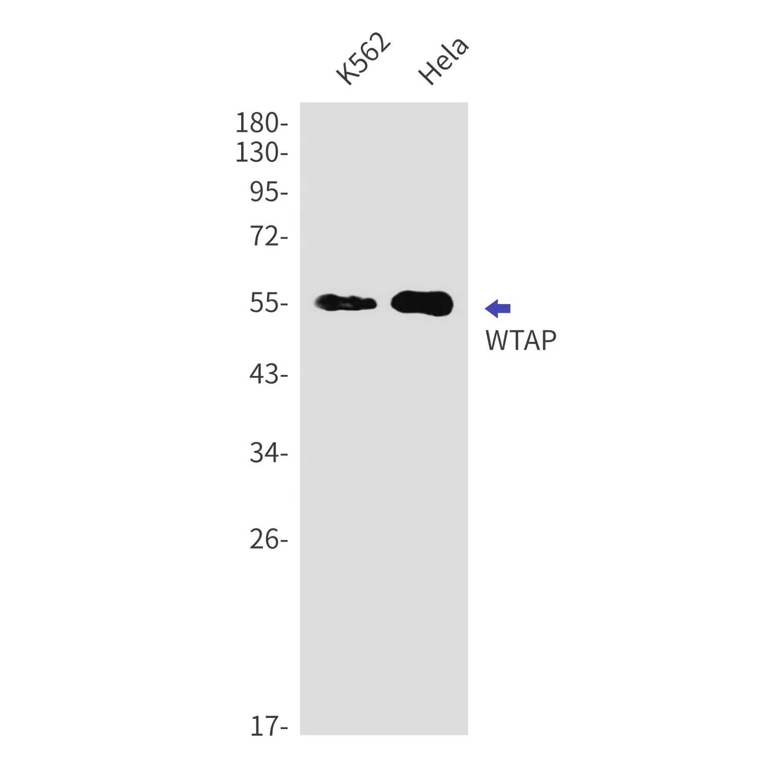 WTAP Rabbit Monoclonal Antibody - Size: 100µl