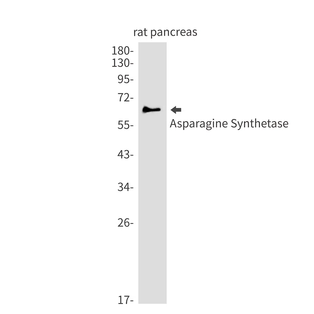 Asparagine Synthetase Rabbit Monoclonal Antibody - Size: 100µl