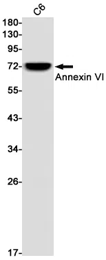 Annexin VI Rabbit Monoclonal Antibody - Size: 100µl