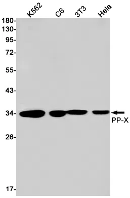 PPP4C Rabbit Monoclonal Antibody