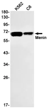 Menin Rabbit Monoclonal Antibody - Size: 50µl