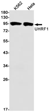 UHRF1 Rabbit Monoclonal Antibody - Size: 50µl
