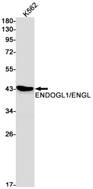 ENDOGL1 Rabbit Monoclonal Antibody - Size: 50µl