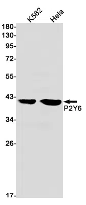 P2Y6 Rabbit Monoclonal Antibody - Size: 100µl