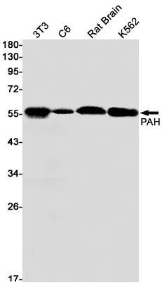 PAH Rabbit Monoclonal Antibody - Size: 50µl