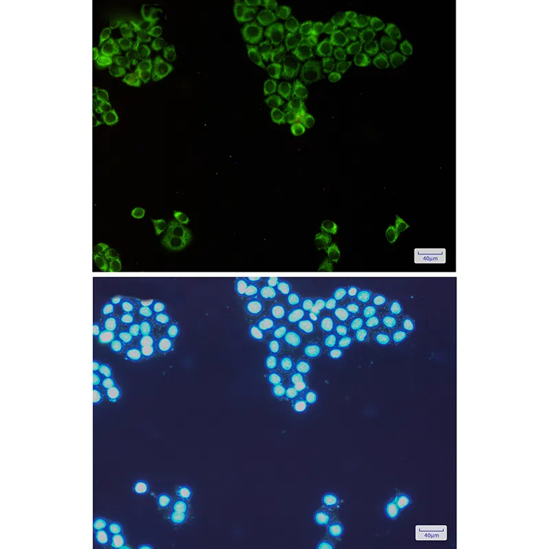 Immunocytochemistry(ICC) - PKR Rabbit Monoclonal Antibody AMRe85152