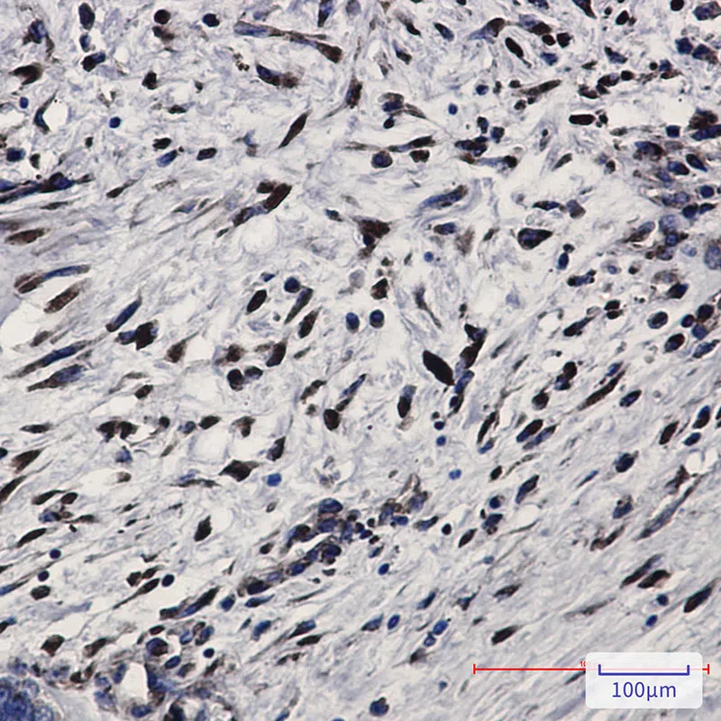Immunohistochemistry(IHC) - PKR Rabbit Monoclonal Antibody AMRe85152