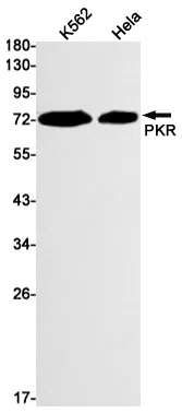 PKR Rabbit Monoclonal Antibody - Size: 100µl