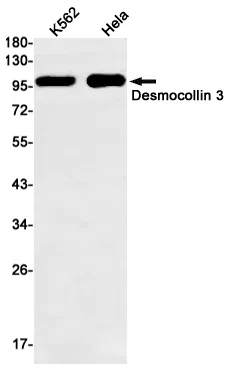 Desmocollin 3 Rabbit Monoclonal Antibody - Size: 100µl