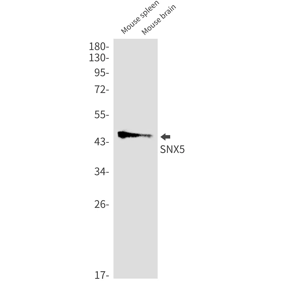 SNX5 Rabbit Monoclonal Antibody - Size: 50µl