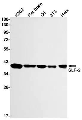 SLP2 Rabbit Monoclonal Antibody - Size: 50µl