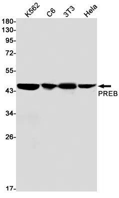 PREB Rabbit Monoclonal Antibody - Size: 100µl