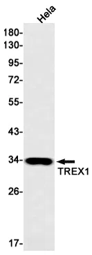 TREX1 Rabbit Monoclonal Antibody - Size: 50µl