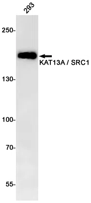 KAT13A Rabbit Monoclonal Antibody