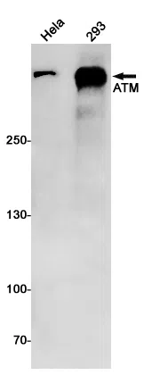 ATM Rabbit Monoclonal Antibody - Size: 100µl
