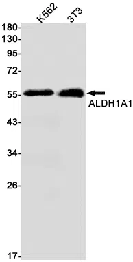 ALDH1A1 Rabbit Monoclonal Antibody - Size: 100µl