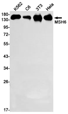 MSH6 Rabbit Monoclonal Antibody - Size: 50µl