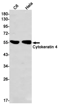 Cytokeratin 4 Rabbit Monoclonal Antibody - Size: 100µl