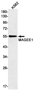 MAGEC2 Rabbit Monoclonal Antibody - Size: 50µl