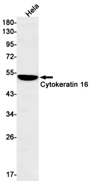Cytokeratin 16 Rabbit Monoclonal Antibody - Size: 50µl