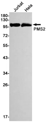 PMS2 Rabbit Monoclonal Antibody - Size: 100µl