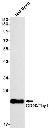CD90 Rabbit Monoclonal Antibody