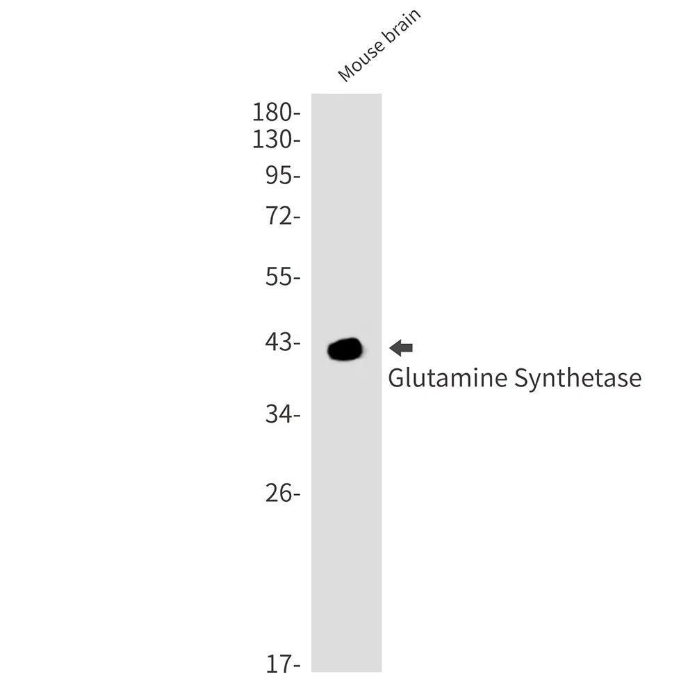 Glutamine Synthetase Rabbit Monoclonal Antibody - Size: 100µl