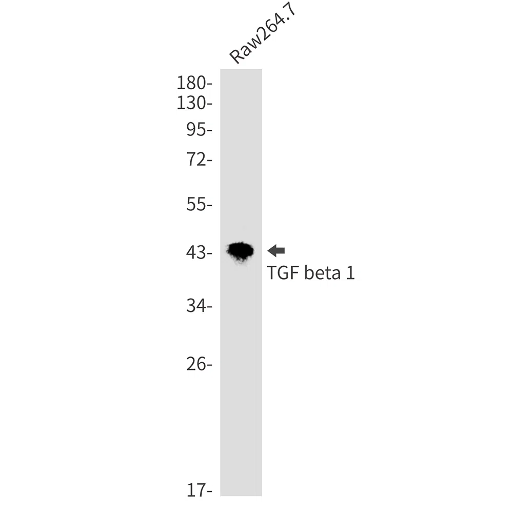TGF beta 1 Rabbit Monoclonal Antibody - Size: 50µl