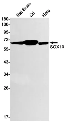 SOX10 Rabbit Monoclonal Antibody - Size: 100µl