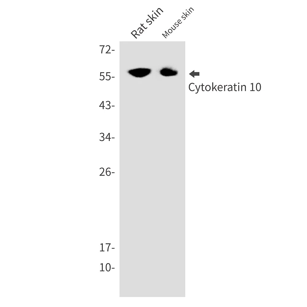 Cytokeratin 10 Rabbit Monoclonal Antibody - Size: 50µl