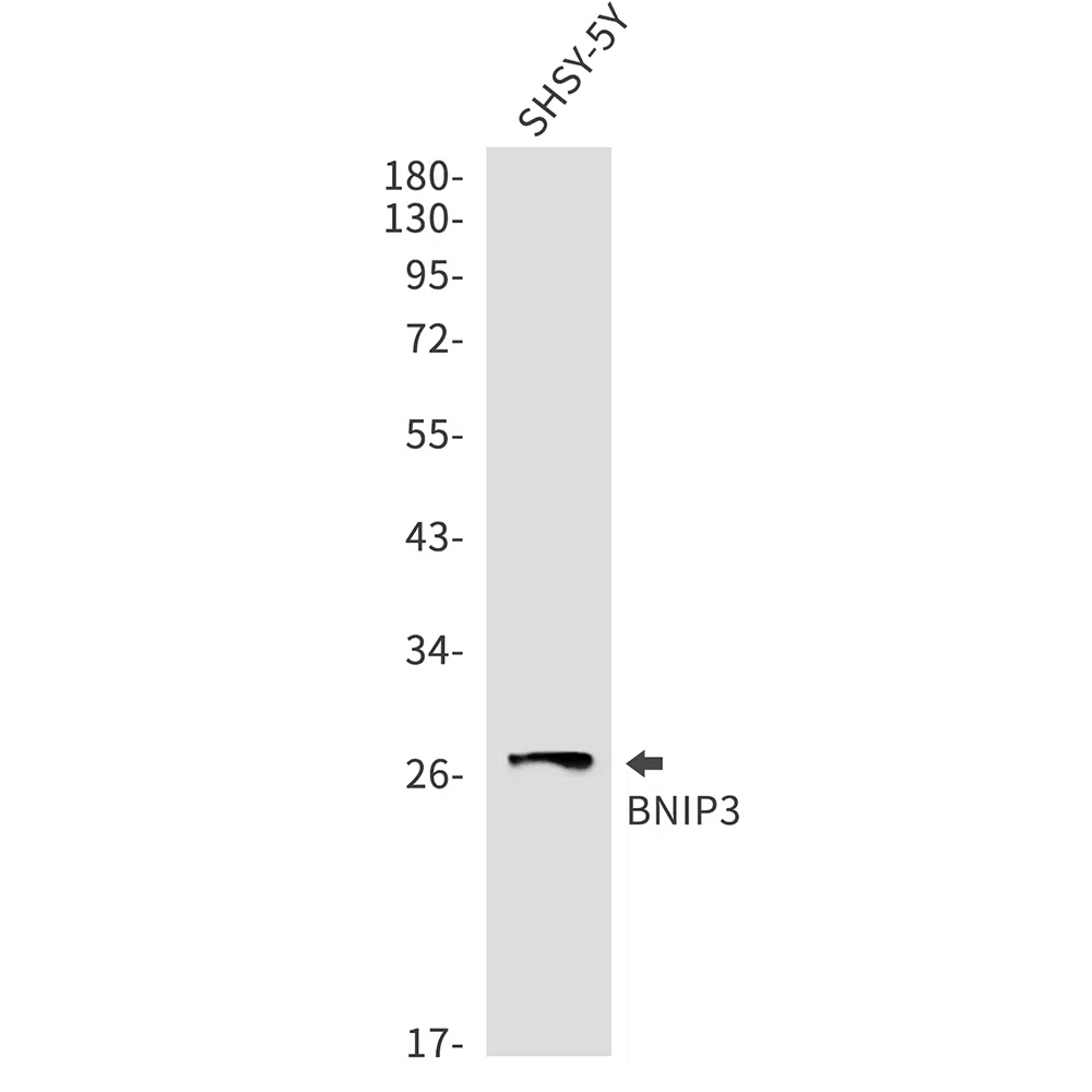 BNIP3 Rabbit Monoclonal Antibody - Size: 50µl