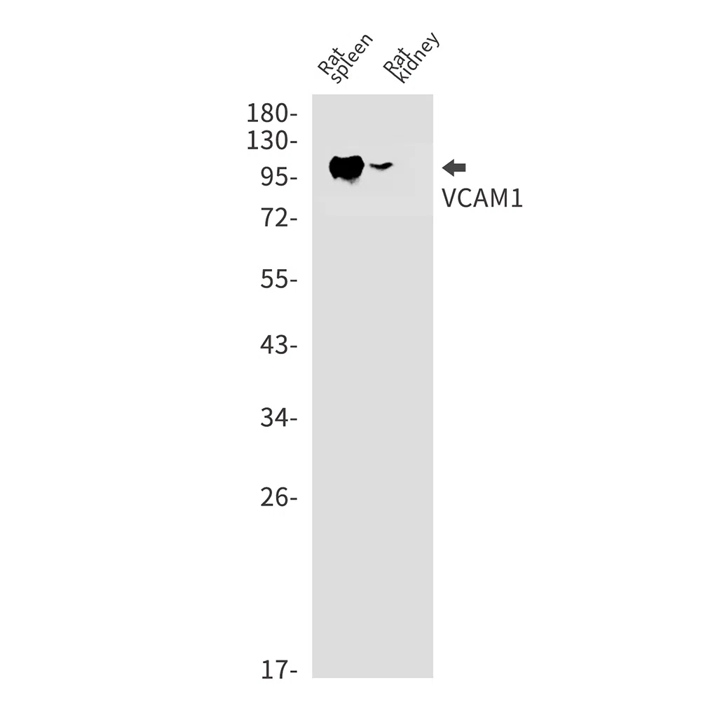 VCAM1 Rabbit Monoclonal Antibody - Size: 50µl