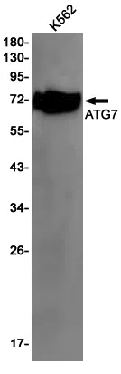 ATG7 Rabbit Monoclonal Antibody - Size: 100µl