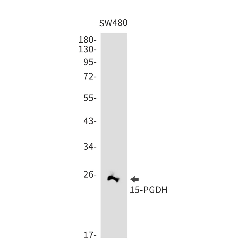 15 PGDH Rabbit Monoclonal Antibody - Size: 100µl