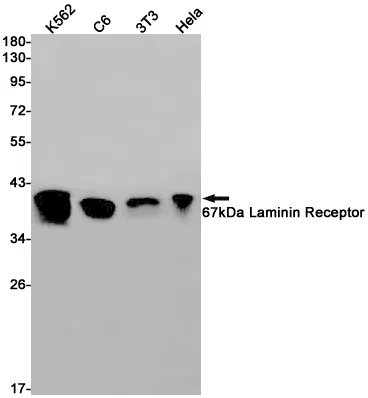 67kDa Laminin Receptor Rabbit Monoclonal Antibody - Size: 50µl