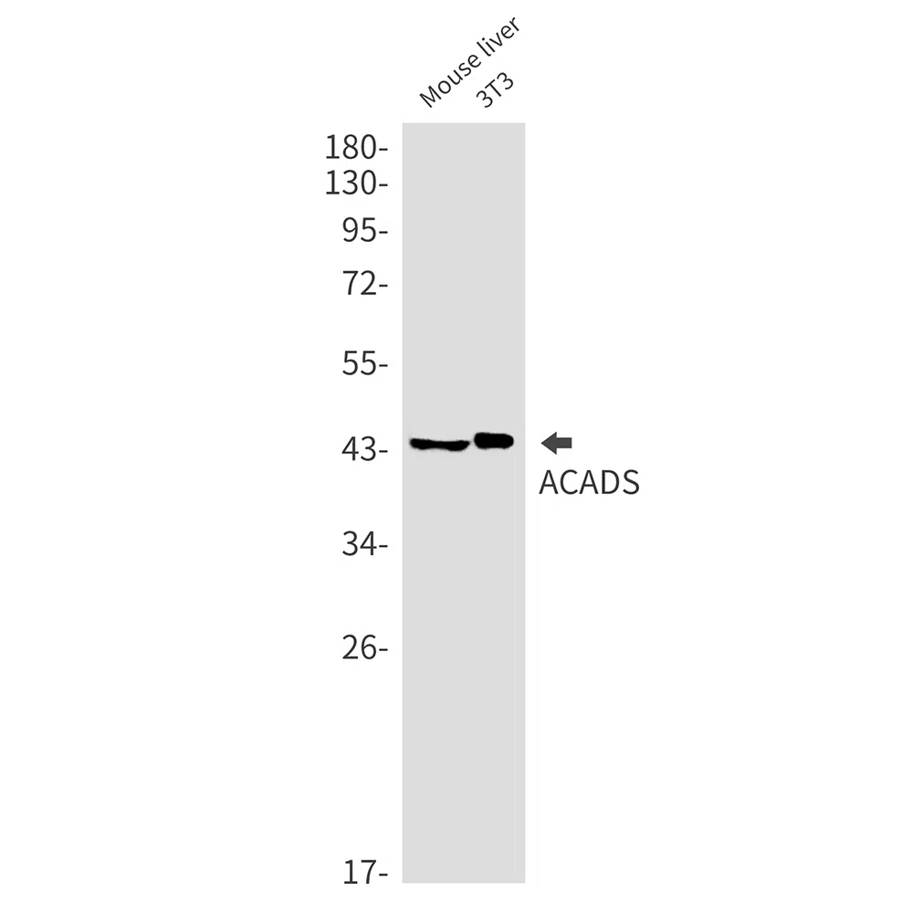 ACADS Rabbit Monoclonal Antibody - Size: 50µl