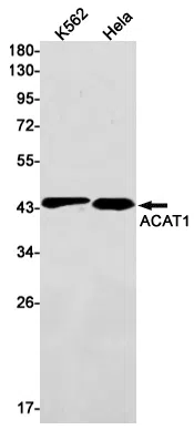 ACAT1 Rabbit Monoclonal Antibody - Size: 100µl