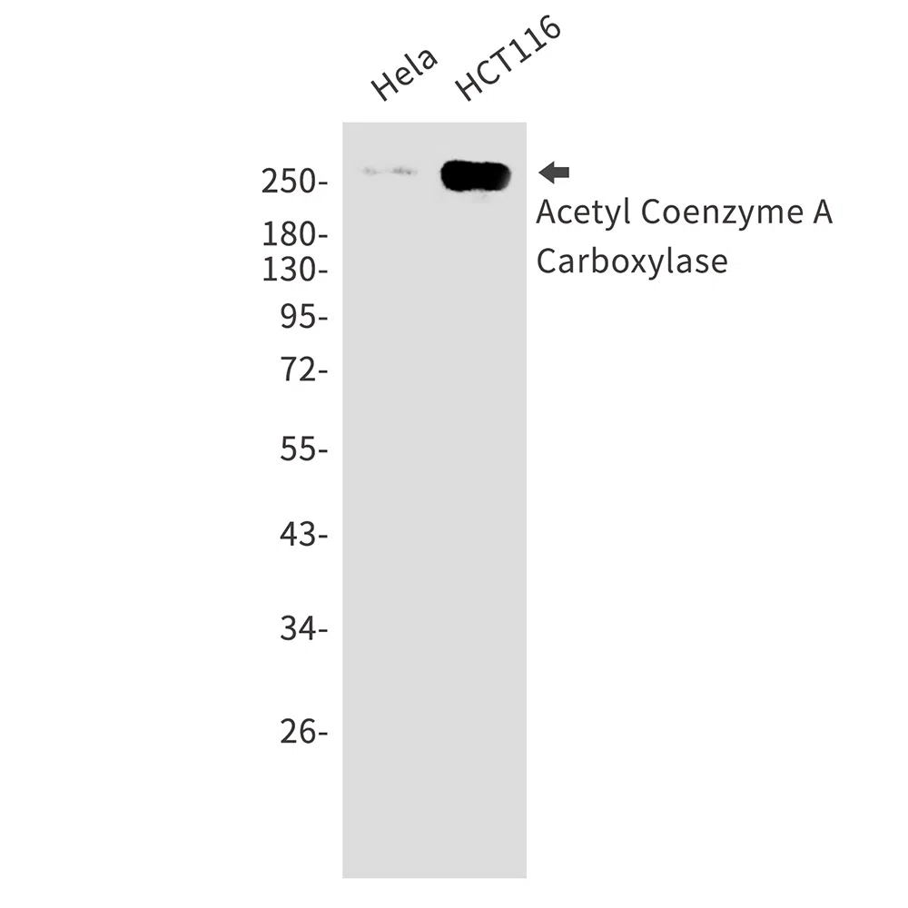 Acetyl-Coenzyme A Carboxylase Rabbit Monoclonal Antibody - Size: 100µl